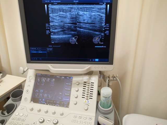 乳腺超音波検査