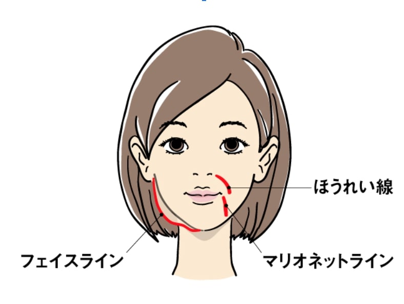 老け顔の原因 口元のシワの原因とタイプ別の目立たせなくする方法 ウレハダ うれしいお肌 ずっと続く